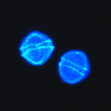 Calcafluor-stained <em>A. catenella</em> cells isolated from the Chukchi Sea, viewed under fluorescence microscopy.