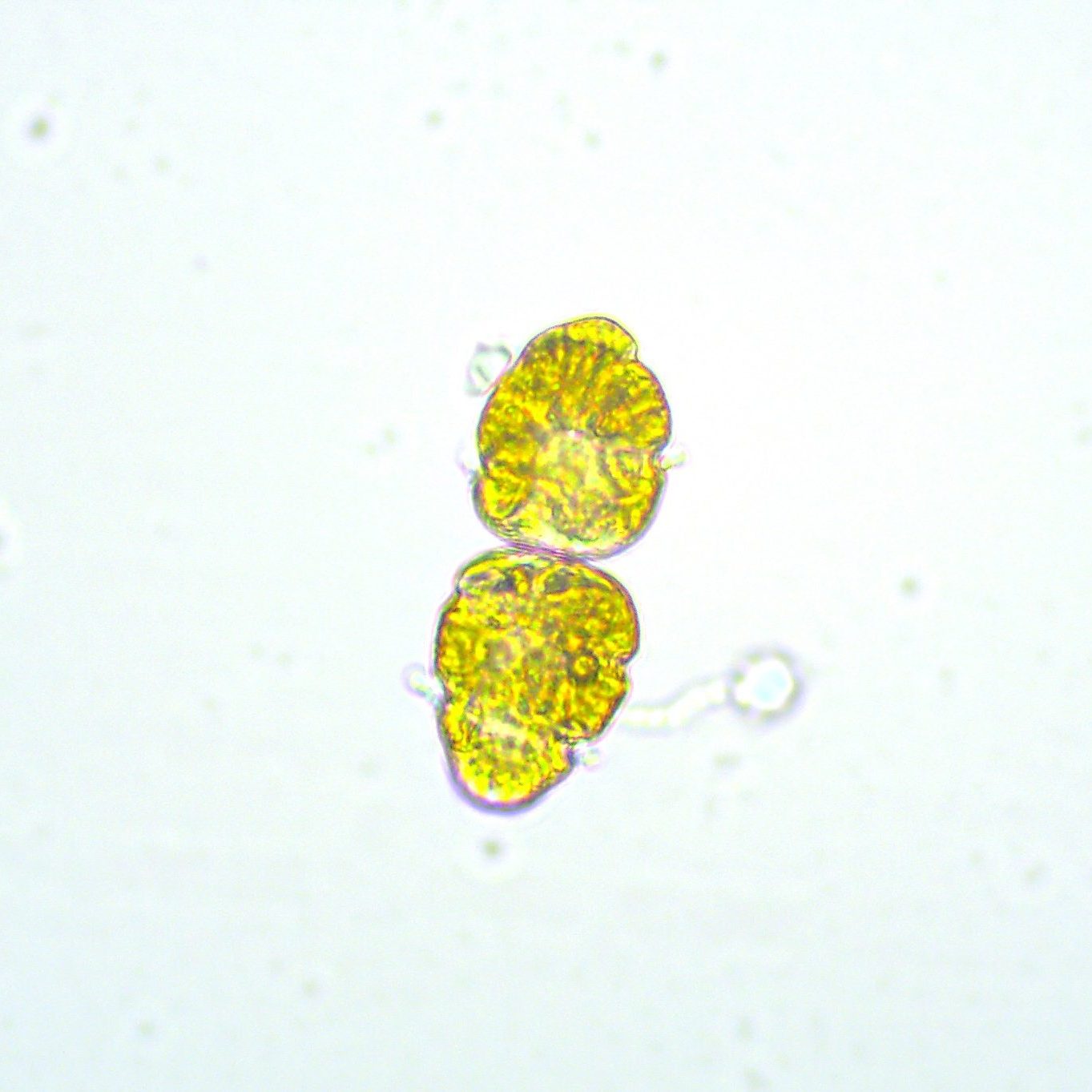 Light microscopy image of <i>M. polykrikoides</i>. Image courtesy of C. Heil, taken during MERHAB course on the Identification of HABs.